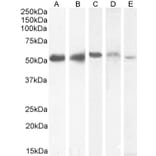 Western Blot - Anti-KPNA2 Antibody (A83997) - Antibodies.com