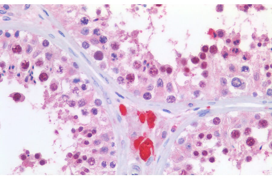 Immunohistochemistry - Anti-KPNA2 Antibody (A83997) - Antibodies.com