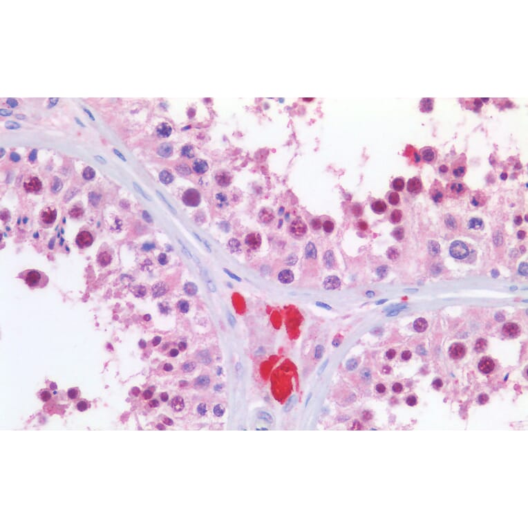 Immunohistochemistry - Anti-KPNA2 Antibody (A83997) - Antibodies.com