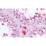 Immunohistochemistry - Anti-KPNA2 Antibody (A83997) - Antibodies.com