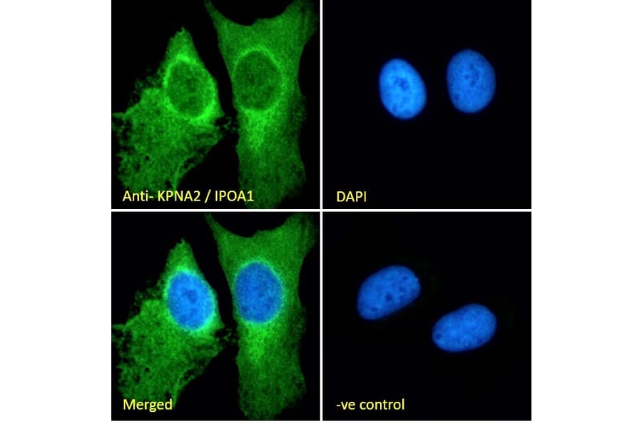 Immunofluorescence - Anti-KPNA2 Antibody (A83997) - Antibodies.com