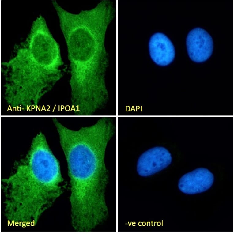 Immunofluorescence - Anti-KPNA2 Antibody (A83997) - Antibodies.com