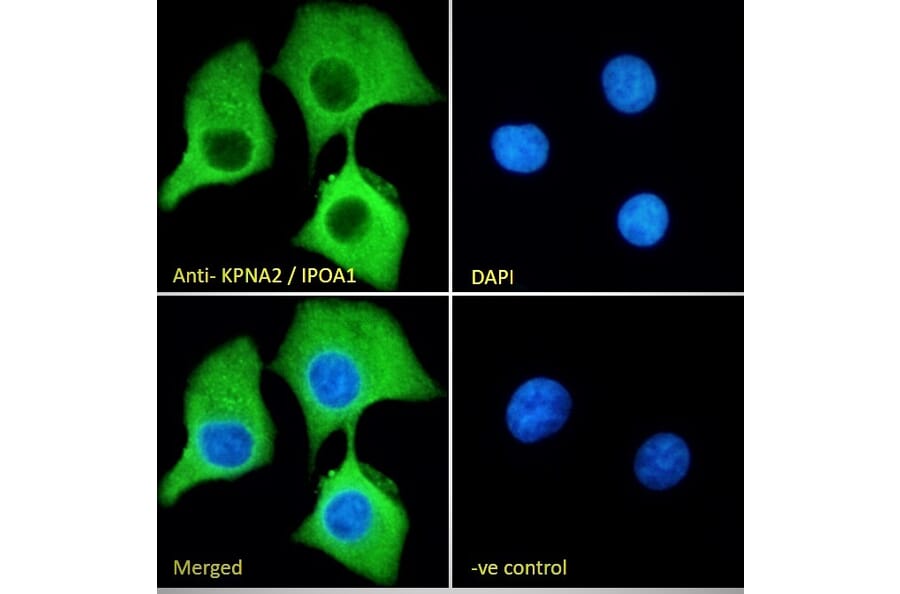 Immunofluorescence - Anti-KPNA2 Antibody (A83997) - Antibodies.com