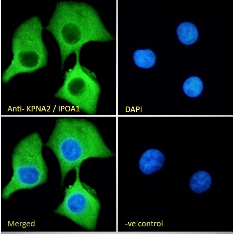 Immunofluorescence - Anti-KPNA2 Antibody (A83997) - Antibodies.com