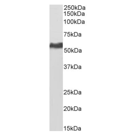 Western Blot - Anti-KPNA2 Antibody (A83998) - Antibodies.com