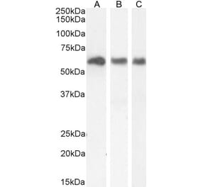 Western Blot - Anti-KPNA3 Antibody (A83999) - Antibodies.com