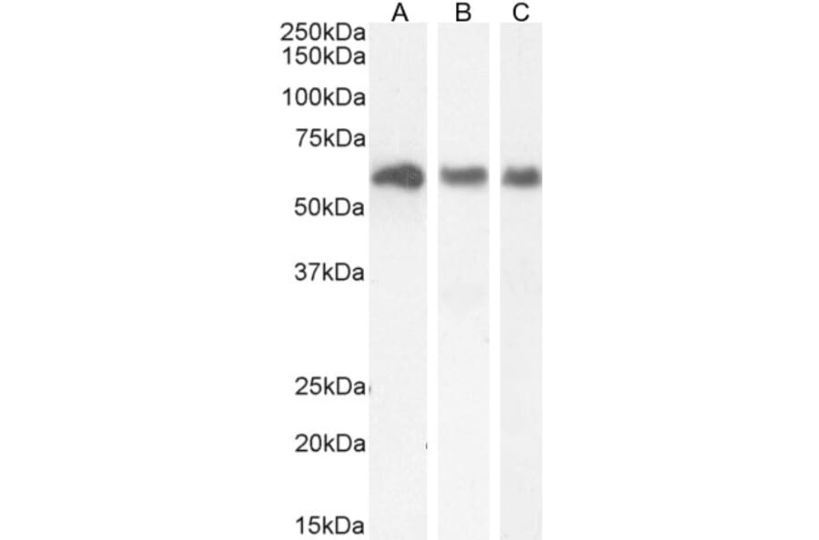 Western Blot - Anti-KPNA3 Antibody (A83999) - Antibodies.com