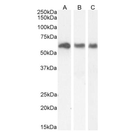 Western Blot - Anti-KPNA3 Antibody (A83999) - Antibodies.com