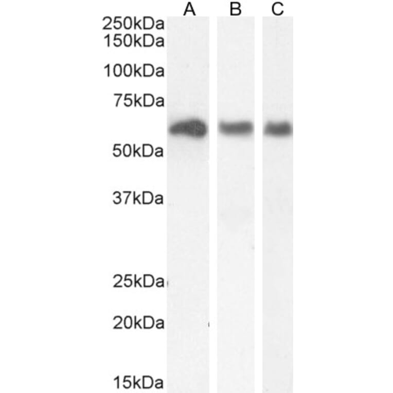 Western Blot - Anti-KPNA3 Antibody (A83999) - Antibodies.com
