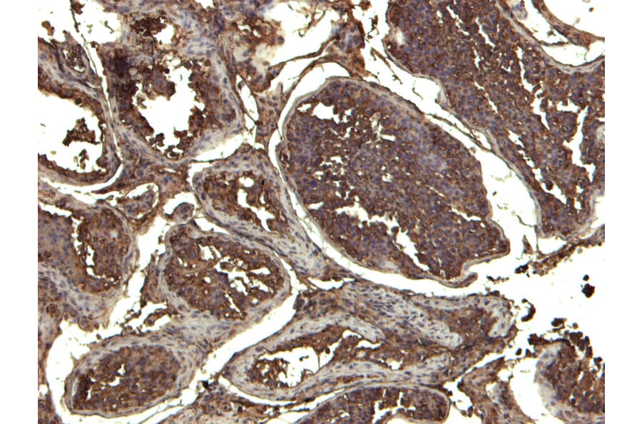Immunohistochemistry - Anti-KPNA3 Antibody (A83999) - Antibodies.com