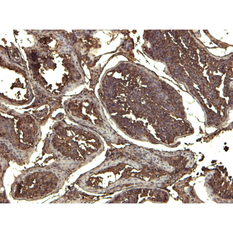 Immunohistochemistry - Anti-KPNA3 Antibody (A83999) - Antibodies.com