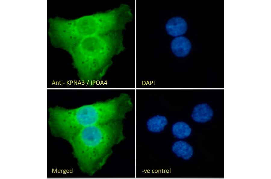 Immunofluorescence - Anti-KPNA3 Antibody (A83999) - Antibodies.com