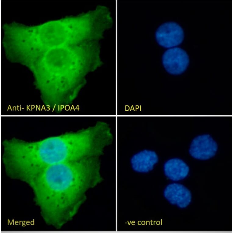Immunofluorescence - Anti-KPNA3 Antibody (A83999) - Antibodies.com