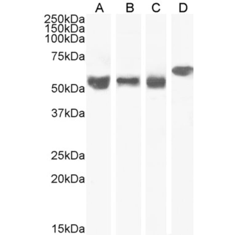 Western Blot - Anti-KPNA4 Antibody (A84001) - Antibodies.com