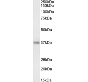 Western Blot - Anti-RIL Antibody (A84002) - Antibodies.com