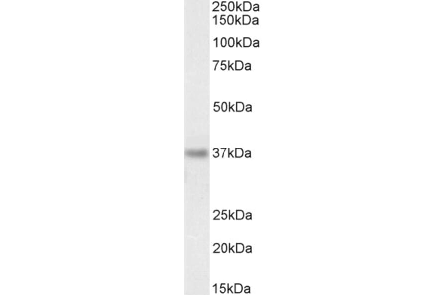 Western Blot - Anti-RIL Antibody (A84002) - Antibodies.com