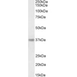 Western Blot - Anti-RIL Antibody (A84002) - Antibodies.com