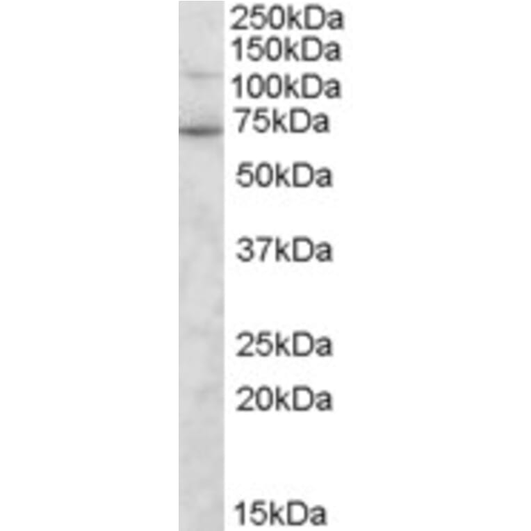 Western Blot - Anti-Syntrophin gamma 2 Antibody (A84003) - Antibodies.com