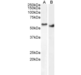 Western Blot - Anti-STK35 Antibody (A84004) - Antibodies.com