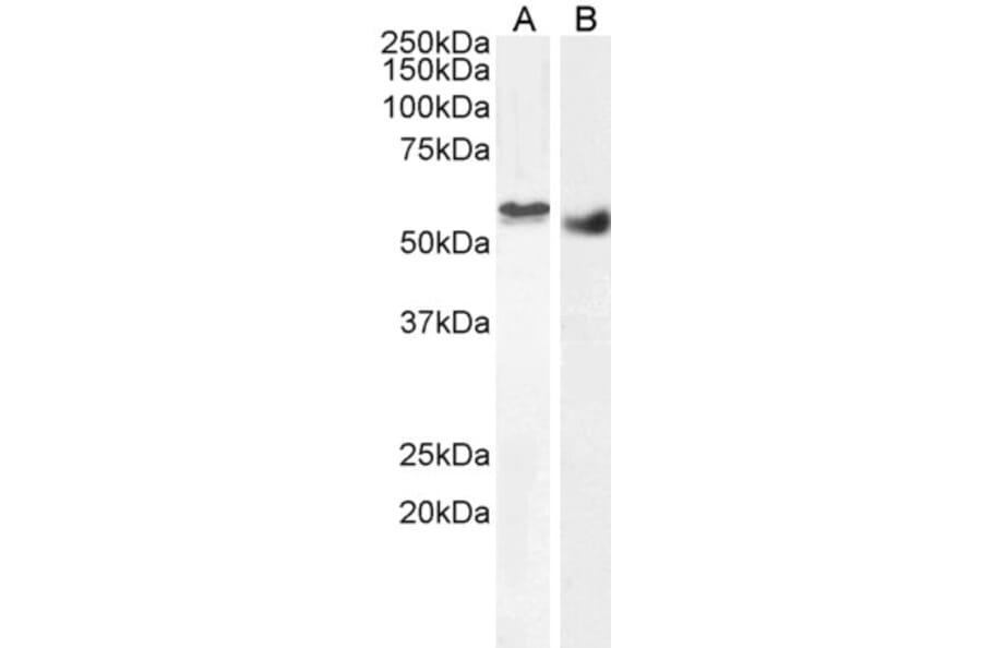 Western Blot - Anti-STK35 Antibody (A84004) - Antibodies.com
