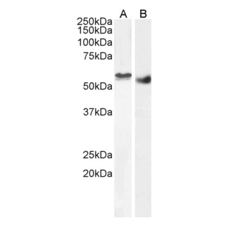 Western Blot - Anti-STK35 Antibody (A84004) - Antibodies.com