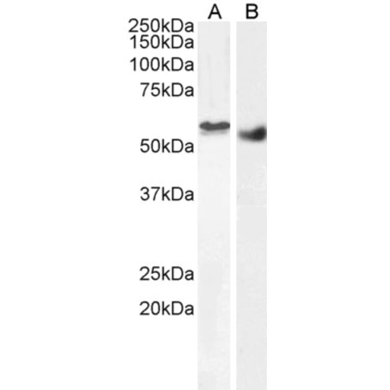 Western Blot - Anti-STK35 Antibody (A84004) - Antibodies.com