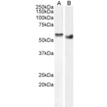 Western Blot - Anti-STK35 Antibody (A84004) - Antibodies.com