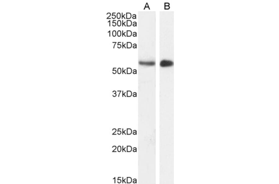 Western Blot - Anti-STK35 Antibody (A84004) - Antibodies.com