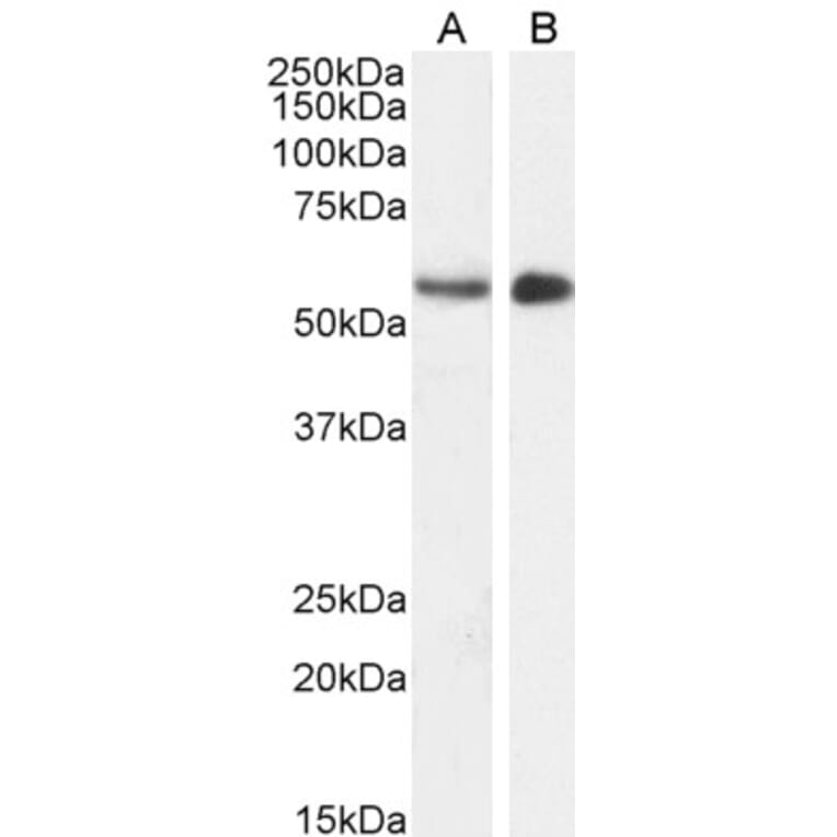 Western Blot - Anti-STK35 Antibody (A84004) - Antibodies.com