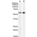 Western Blot - Anti-STK35 Antibody (A84004) - Antibodies.com
