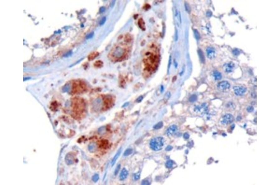 Immunohistochemistry - Anti-STK35 Antibody (A84004) - Antibodies.com
