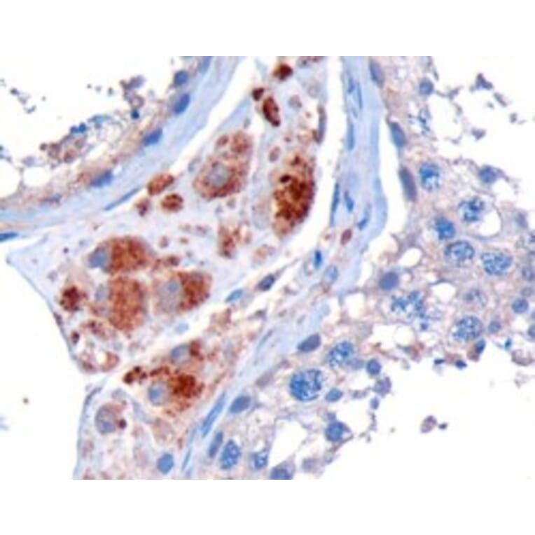 Immunohistochemistry - Anti-STK35 Antibody (A84004) - Antibodies.com