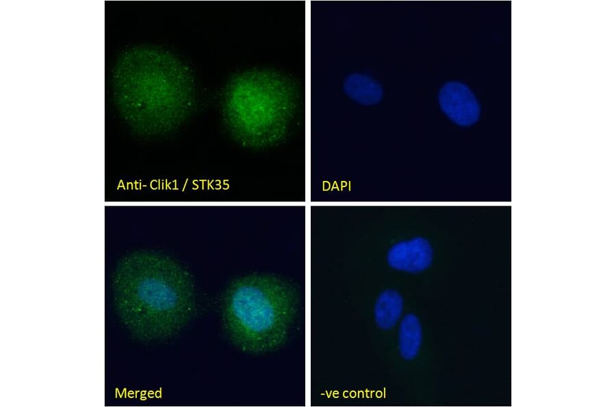 Immunofluorescence - Anti-STK35 Antibody (A84004) - Antibodies.com