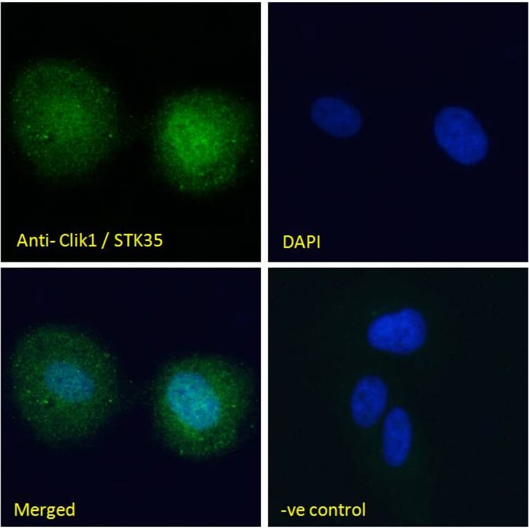 Immunofluorescence - Anti-STK35 Antibody (A84004) - Antibodies.com