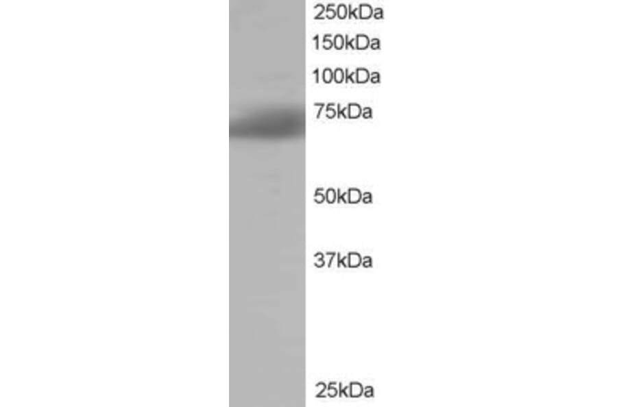 Western Blot - Anti-SH3BP1 Antibody (A84005) - Antibodies.com