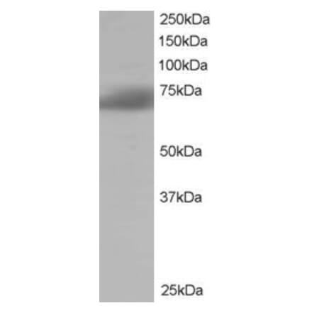 Western Blot - Anti-SH3BP1 Antibody (A84005) - Antibodies.com