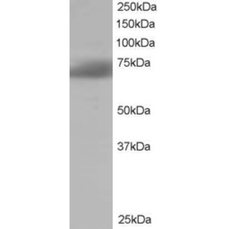 Western Blot - Anti-SH3BP1 Antibody (A84005) - Antibodies.com