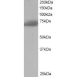Western Blot - Anti-SH3BP1 Antibody (A84005) - Antibodies.com