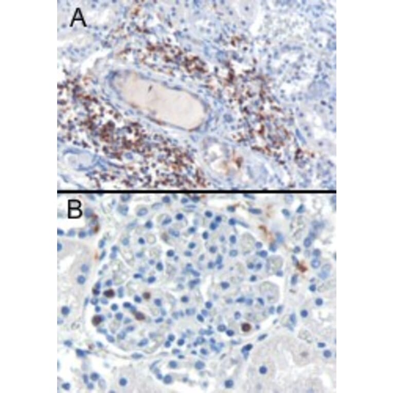 Immunohistochemistry - Anti-SH3BP1 Antibody (A84005) - Antibodies.com