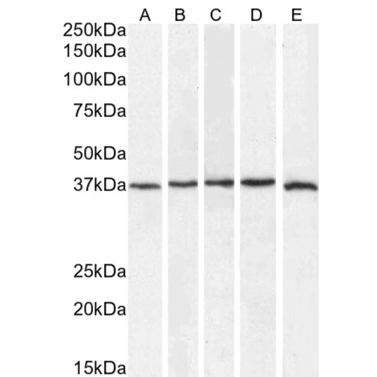 Western Blot - Anti-SIRT4 Antibody (A84006) - Antibodies.com