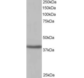 Western Blot - Anti-SIRT4 Antibody (A84006) - Antibodies.com