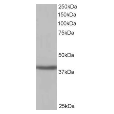 Western Blot - Anti-SIRT4 Antibody (A84006) - Antibodies.com