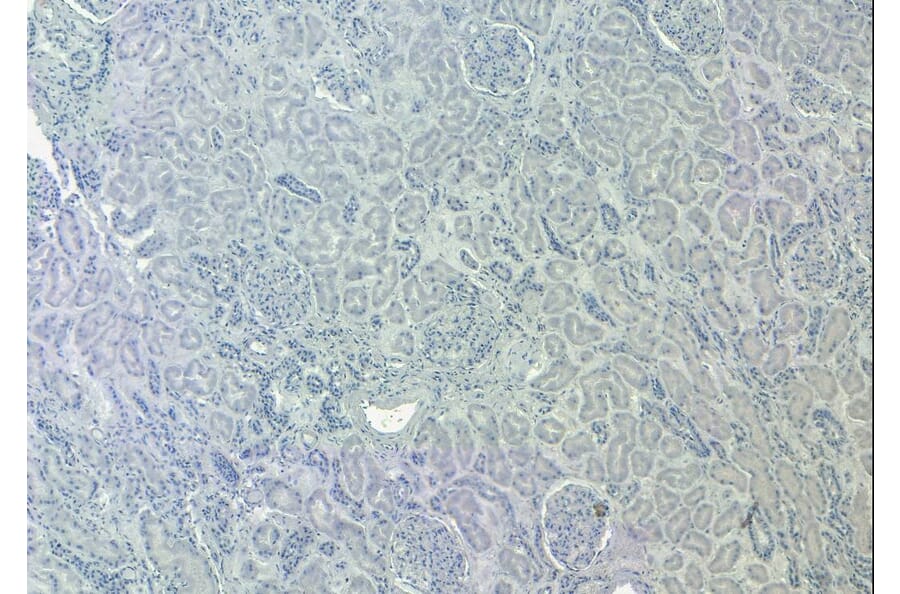Immunohistochemistry - Anti-SIRT4 Antibody (A84006) - Antibodies.com