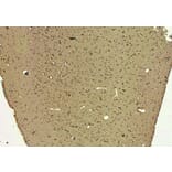 Immunohistochemistry - Anti-SIRT4 Antibody (A84006) - Antibodies.com