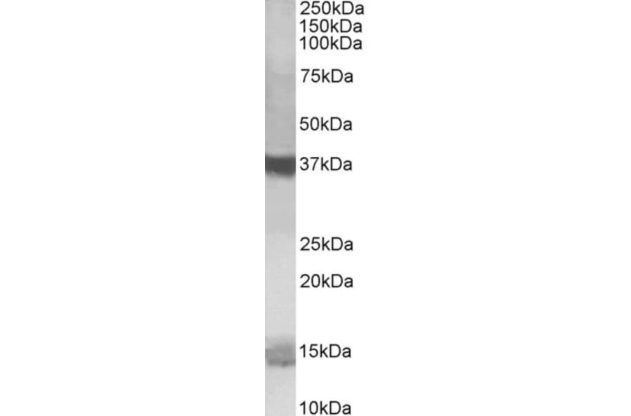 Western Blot - Anti-PFDN1 Antibody (A84008) - Antibodies.com
