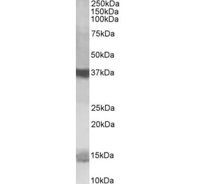 Western Blot - Anti-PFDN1 Antibody (A84008) - Antibodies.com