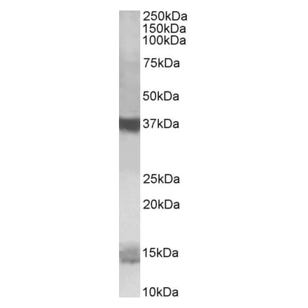 Western Blot - Anti-PFDN1 Antibody (A84008) - Antibodies.com