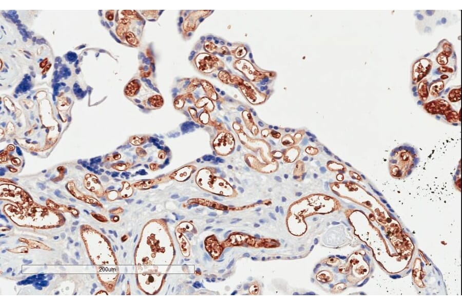 Immunohistochemistry - Anti-PI 3 Kinase Class 2A/Cpk Antibody (A84009) - Antibodies.com