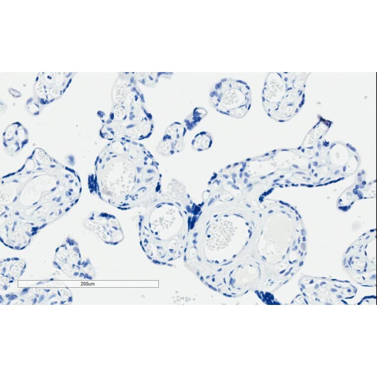 Immunohistochemistry - Anti-PI 3 Kinase Class 2A/Cpk Antibody (A84009) - Antibodies.com