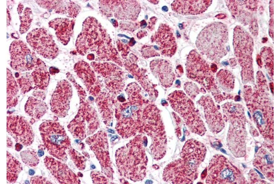 Immunohistochemistry - Anti-PI 3 Kinase Class 2A/Cpk Antibody (A84009) - Antibodies.com